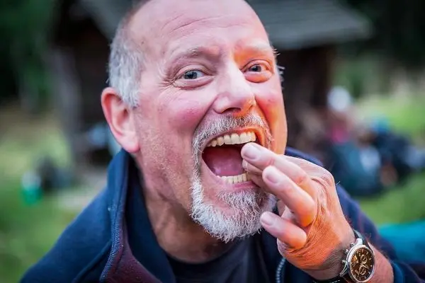 Ein Mann zeigt mit der Hand auf seine Zähne