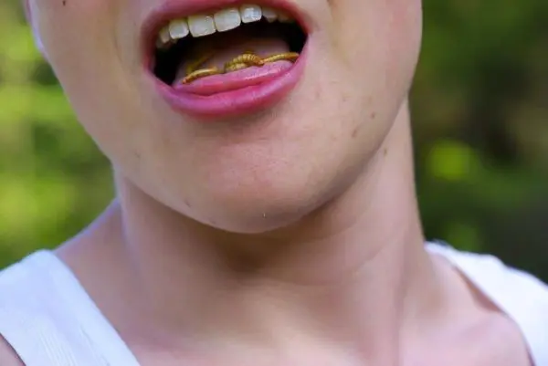 Mund mit sichtbaren Insektenlarven zwischen den Zähnen