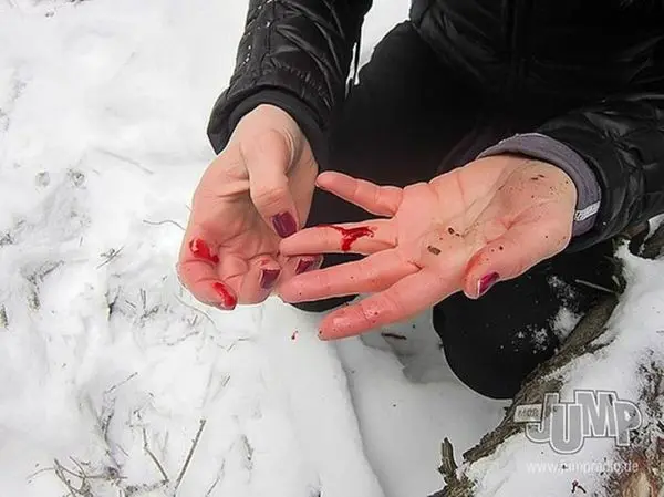 Blutige Hände halten kleine Holzstücke im Schnee