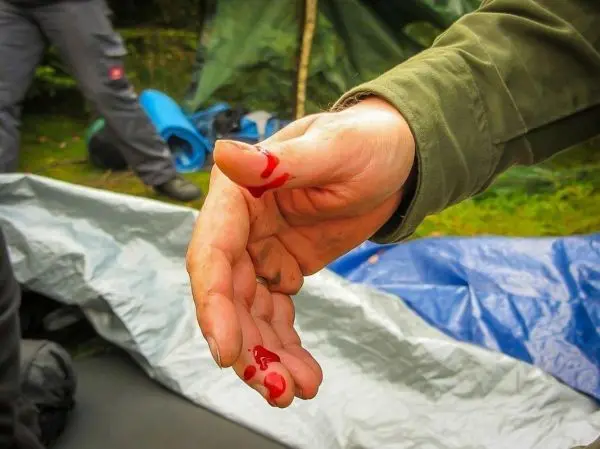 Blutige Hand mit roten Flecken, im Hintergrund Zelt und Ausrüstung sichtbar