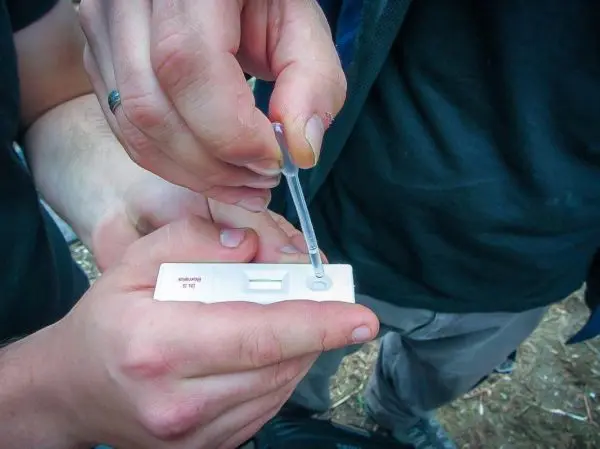 Hände halten eine Pipette über einen Teststreifen zur Durchführung eines Tests