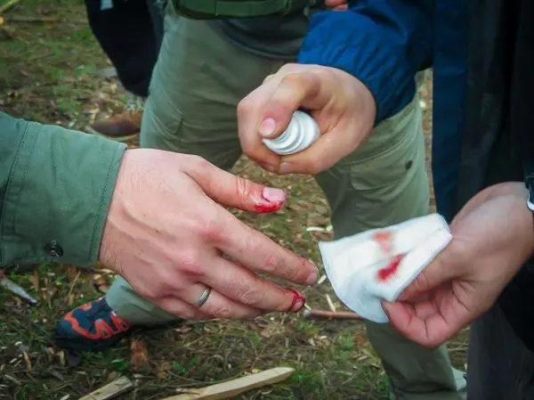 Hände mit Blut und Verbandmaterial zur Wundversorgung