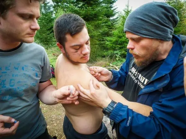 Mann behandelt Wunde am Oberarm eines anderen Mannes im Wald