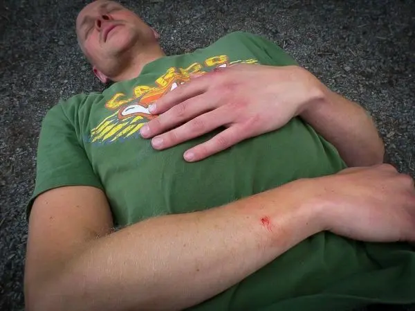 Mann liegt auf dem Boden mit einer kleinen Wunde am Unterarm