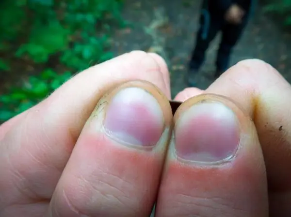 Zwei Daumen halten einen kleinen Gegenstand zwischen sich