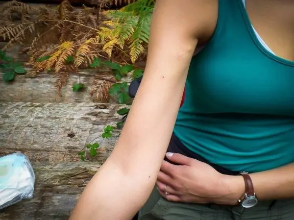 Verbandsmaterial liegt auf einem Baumstamm, eine Hand hält den Arm